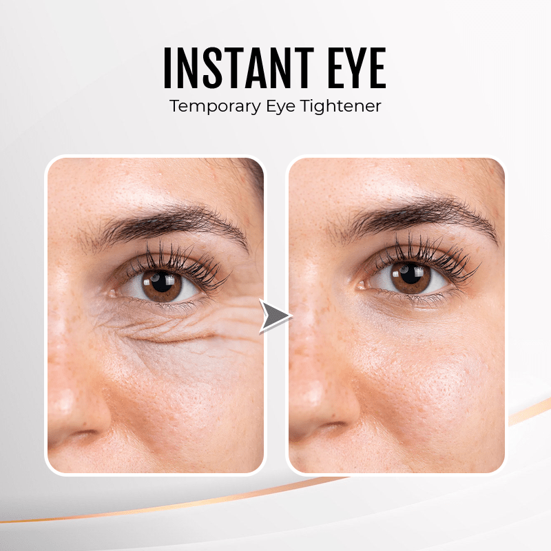 (đ„LAST DAY SALE - 80% OFF) YouthfulLift Eye Firming Cream