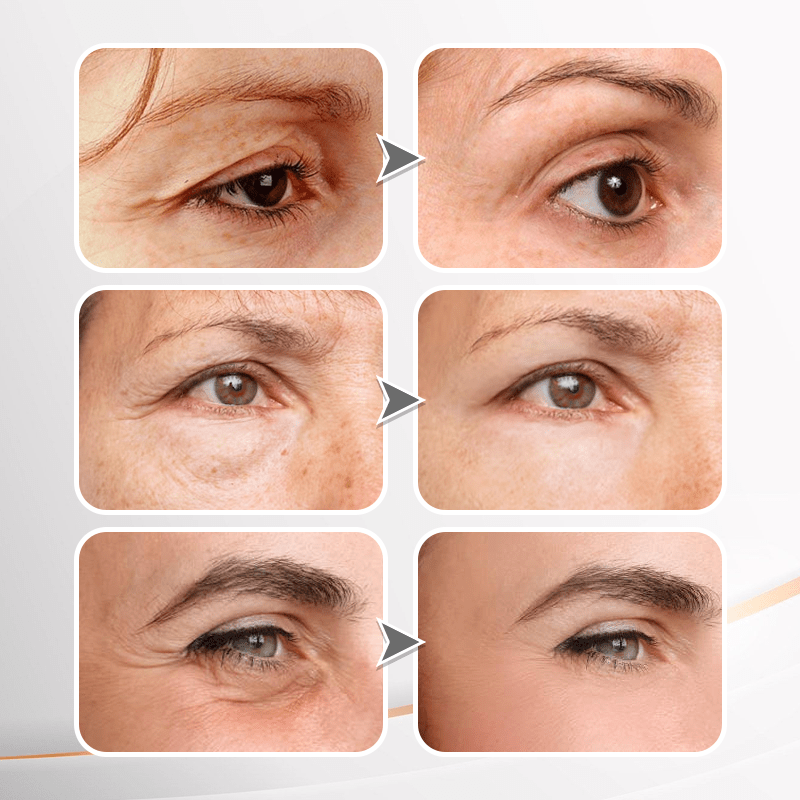 (đ„LAST DAY SALE - 80% OFF) YouthfulLift Eye Firming Cream