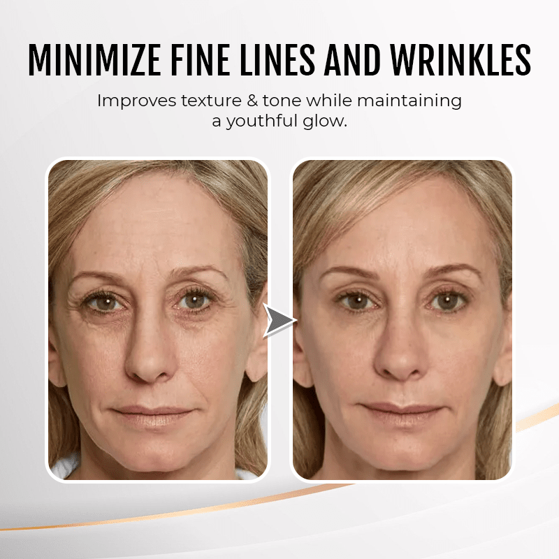 (đ„LAST DAY SALE - 80% OFF) YouthfulLift Eye Firming Cream