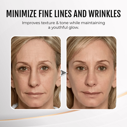 (🔥LAST DAY SALE - 80% OFF) YouthfulLift Eye Firming Cream